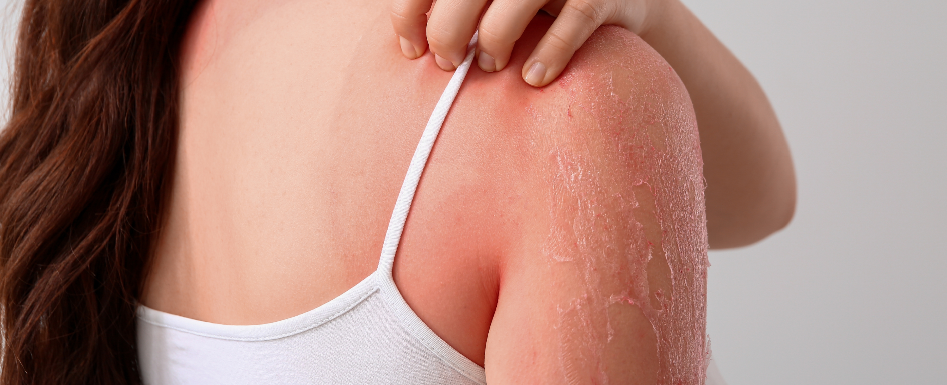 Redness/Sensitive
